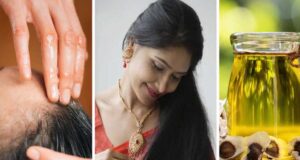 घने और मजबूत बाल चाहिए? इन चीज़ों को डाइट में शामिल करें, बालों की ग्रोथ होगी तेज़
